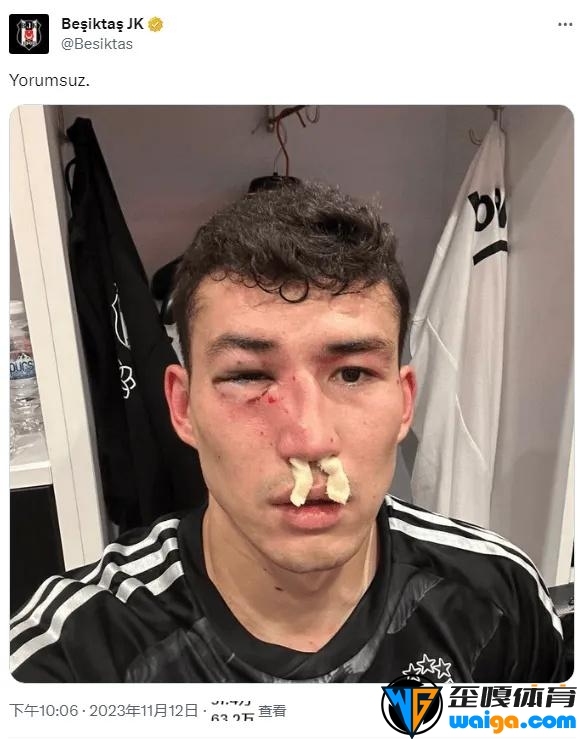 土超联赛一球员比赛中被揍的鼻青脸肿